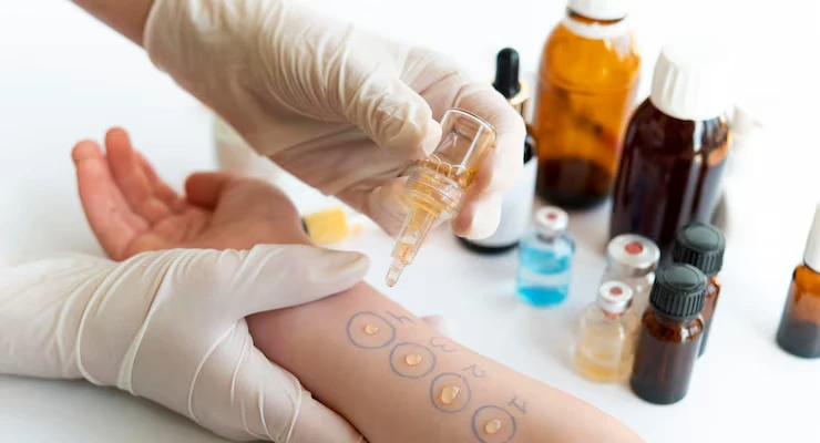 Skin and Nail Biopsy